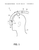 RESPIRATORY INTERFACE DEVICE INCLUDING A MECHANISM FOR MANAGING NOSE     BRIDGE PRESSURE diagram and image