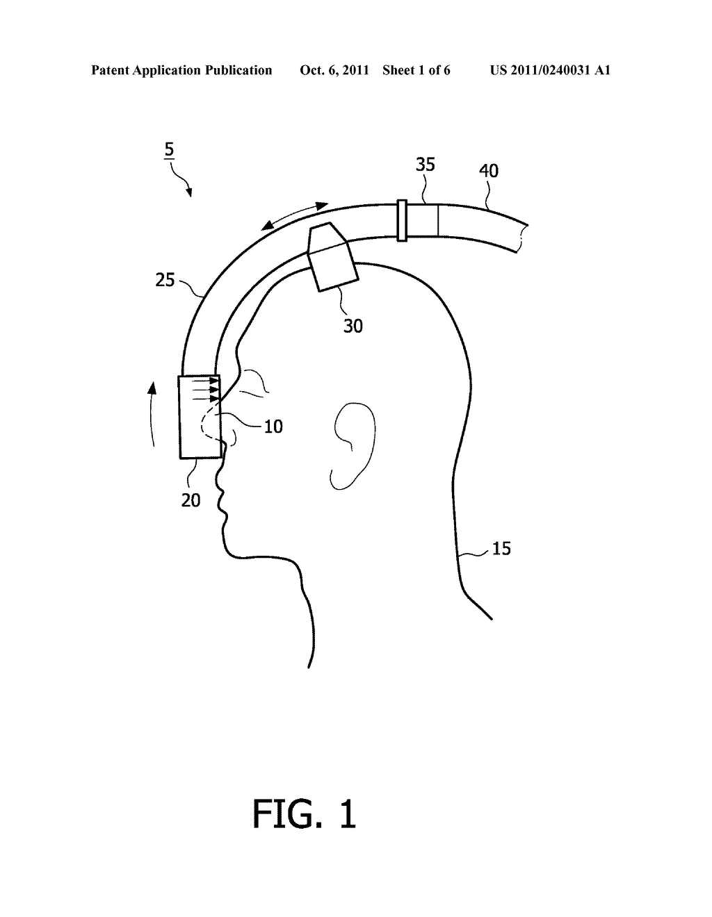 RESPIRATORY INTERFACE DEVICE INCLUDING A MECHANISM FOR MANAGING NOSE     BRIDGE PRESSURE - diagram, schematic, and image 02