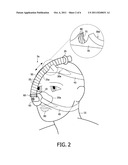 RESPIRATORY INTERFACE DEVICE INCLUDING A MECHANISM FOR MANAGING NOSE     BRIDGE PRESSURE diagram and image