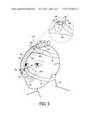 RESPIRATORY INTERFACE DEVICE INCLUDING A MECHANISM FOR MANAGING NOSE     BRIDGE PRESSURE diagram and image