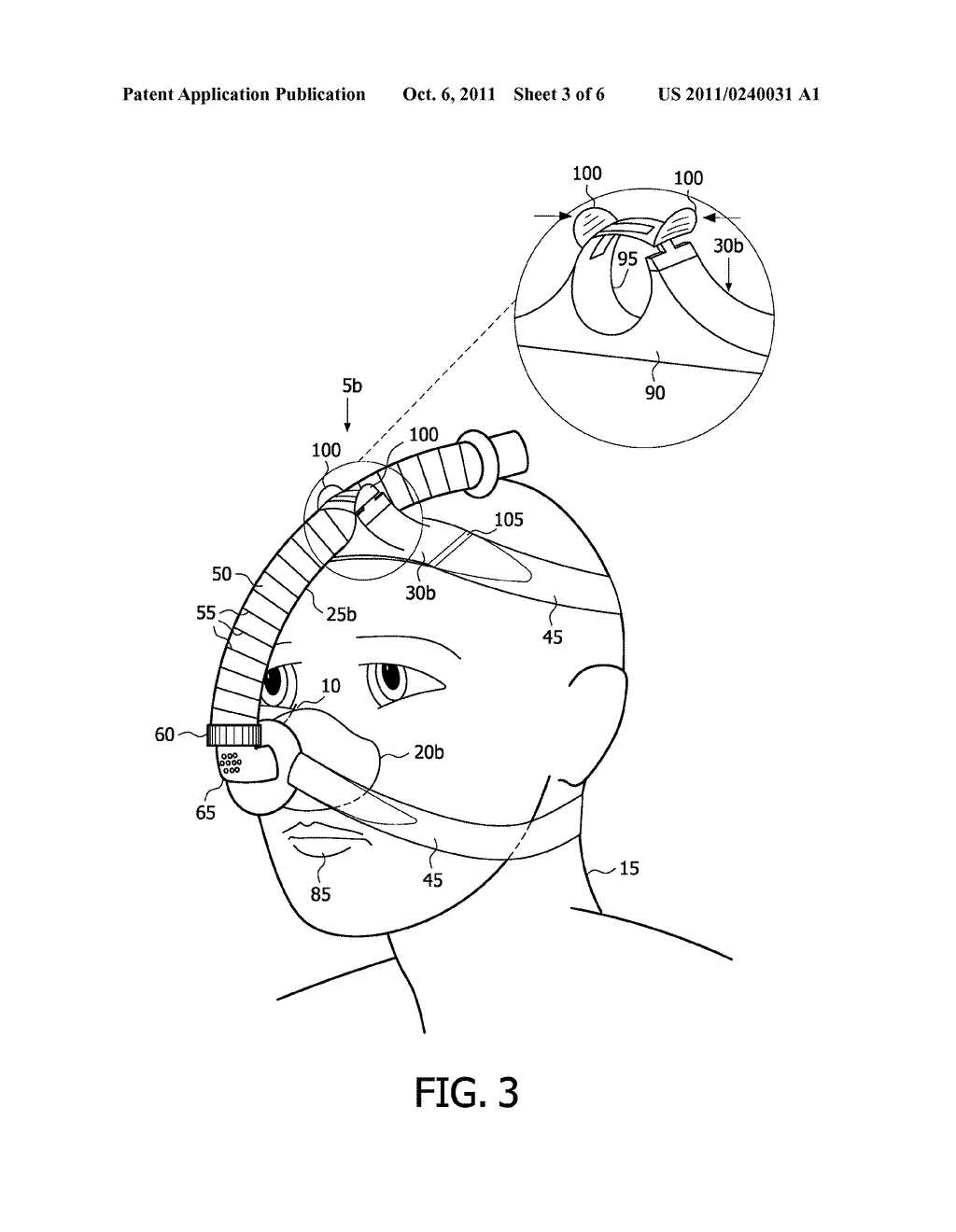RESPIRATORY INTERFACE DEVICE INCLUDING A MECHANISM FOR MANAGING NOSE     BRIDGE PRESSURE - diagram, schematic, and image 04