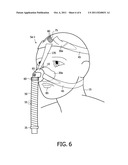 RESPIRATORY INTERFACE DEVICE INCLUDING A MECHANISM FOR MANAGING NOSE     BRIDGE PRESSURE diagram and image