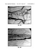 Methods for Strengthening Fractures in Subterranean Formations diagram and image