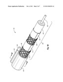 REDUNDANT WEBBING IN CONJOINED CABLES diagram and image