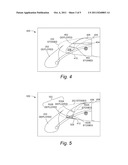 Low Noise Wing Slat System With Deployable Wing Leading Edge Elements diagram and image