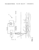 Nano-bubble Generator and Treatments diagram and image