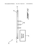 WAFER FLATTENING APPARATUS AND METHOD diagram and image