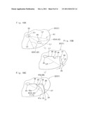 AIRBAG diagram and image