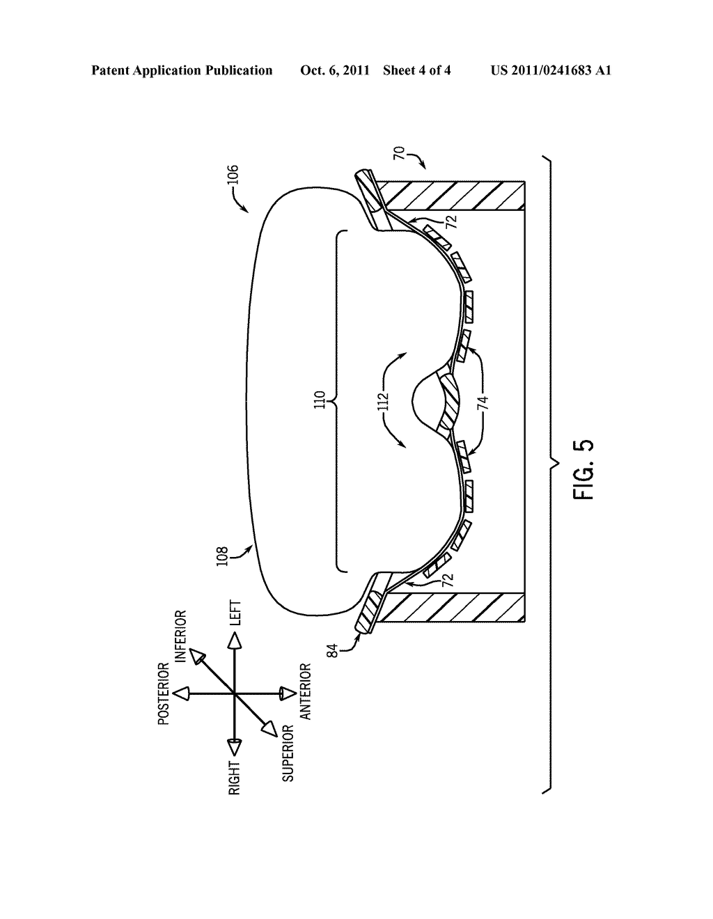 MULTI-CHANNEL BREAST MRI RADIO FREQUENCY RECEIVER COIL - diagram, schematic, and image 05