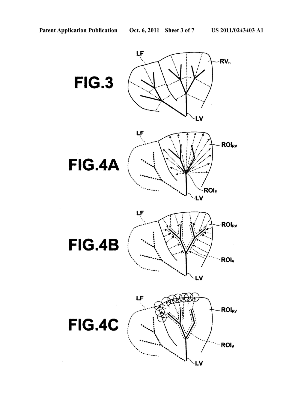 MEDICAL IMAGE PROCESSING APPARATUS AND METHOD, AND COMPUTER READABLE     RECORDING MEDIUM ON WHICH IS RECORDED PROGRAM FOR THE SAME - diagram, schematic, and image 04