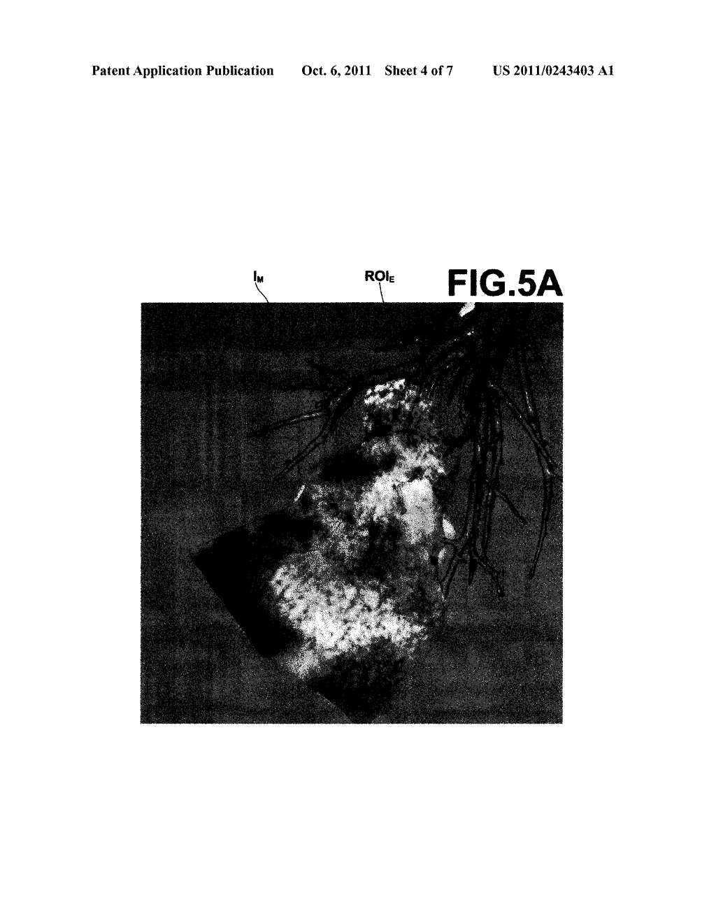 MEDICAL IMAGE PROCESSING APPARATUS AND METHOD, AND COMPUTER READABLE     RECORDING MEDIUM ON WHICH IS RECORDED PROGRAM FOR THE SAME - diagram, schematic, and image 05