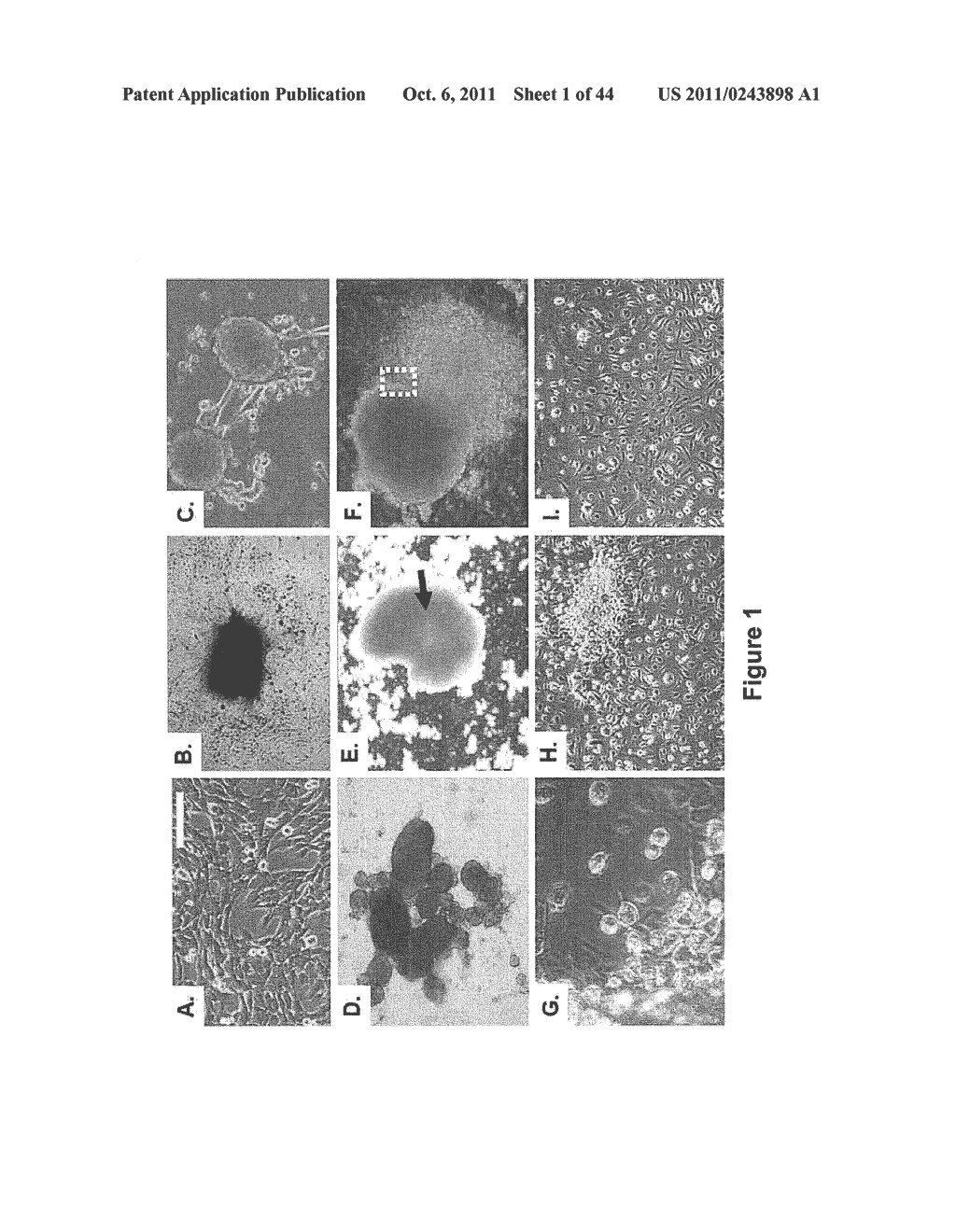 SOMATIC CELL-DERIVED PLURIPOTENT CELLS AND METHODS OF USE THEREFOR - diagram, schematic, and image 02