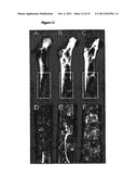 METHODS FOR TREATING BONE CANCER BY ADMINISTERING A NERVE GROWTH FACTOR     ANTAGONIST ANTIBODY diagram and image