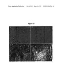 METHODS FOR TREATING BONE CANCER BY ADMINISTERING A NERVE GROWTH FACTOR     ANTAGONIST ANTIBODY diagram and image