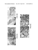 METHODS OF ENHANCING THE IMMUNOGENICITY OF MYCOBACTERIA AND COMPOSITIONS     FOR THE TREATMENT OF CANCER, TUBERCULOSIS, AND FIBROSING LUNG DISEASES diagram and image