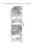 METHODS OF ENHANCING THE IMMUNOGENICITY OF MYCOBACTERIA AND COMPOSITIONS     FOR THE TREATMENT OF CANCER, TUBERCULOSIS, AND FIBROSING LUNG DISEASES diagram and image