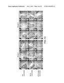 METHODS OF ENHANCING THE IMMUNOGENICITY OF MYCOBACTERIA AND COMPOSITIONS     FOR THE TREATMENT OF CANCER, TUBERCULOSIS, AND FIBROSING LUNG DISEASES diagram and image