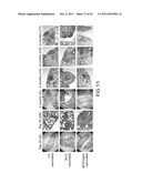 METHODS OF ENHANCING THE IMMUNOGENICITY OF MYCOBACTERIA AND COMPOSITIONS     FOR THE TREATMENT OF CANCER, TUBERCULOSIS, AND FIBROSING LUNG DISEASES diagram and image