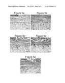 IMPLANTABLE MEDICAL ARTICLES HAVING LAMININ COATINGS AND METHODS OF USE diagram and image