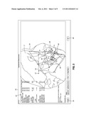 METHOD AND SYSTEM FOR ORTHODONTIC DIAGNOSIS diagram and image