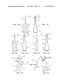 APPARATUS, METHOD AND SYSTEM FOR DENTAL IMPLANTS diagram and image