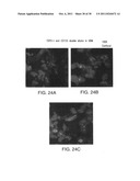 Cancer stem cell immortalization diagram and image