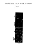 CELL-BASED  DETECTION OF APF THROUGH ITS INTERACTION WITH CKAP4 FOR     DIAGNOSIS OF INTERSTITIAL CYSTITIS diagram and image