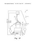 Orthopaedic Component Manufacturing Method and Equipment diagram and image