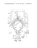 Orthopaedic Component Manufacturing Method and Equipment diagram and image