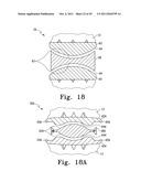 Orthopaedic Component Manufacturing Method and Equipment diagram and image