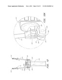 EXERCISE APPARATUS diagram and image