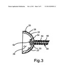 Hemisperical grip handle apparatus diagram and image