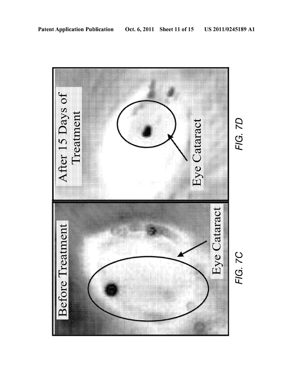 COMPOSITION AND METHOD FOR THE TREATMENT OF EYE DISEASE - diagram, schematic, and image 12