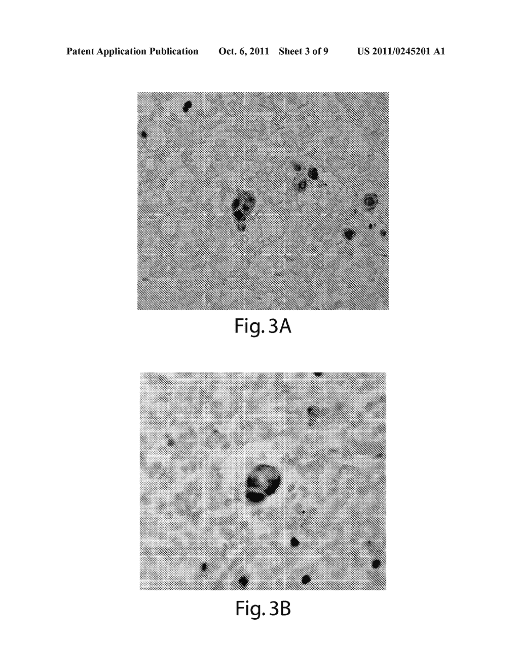 TREATMENT OF CANCER - diagram, schematic, and image 04