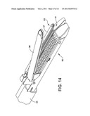 RADIOACTIVE THERAPEUTIC FASTENING INSTRUMENT diagram and image