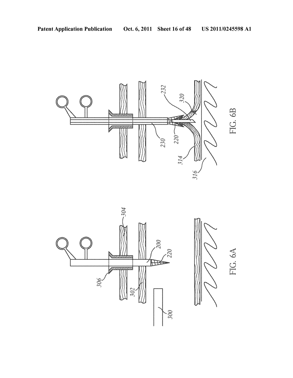 CLOSED LOOP GASTRIC RESTRICTION DEVICES AND METHODS - diagram, schematic, and image 17