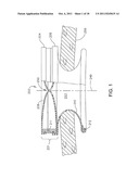 SURGICAL ACCESS DEVICE diagram and image