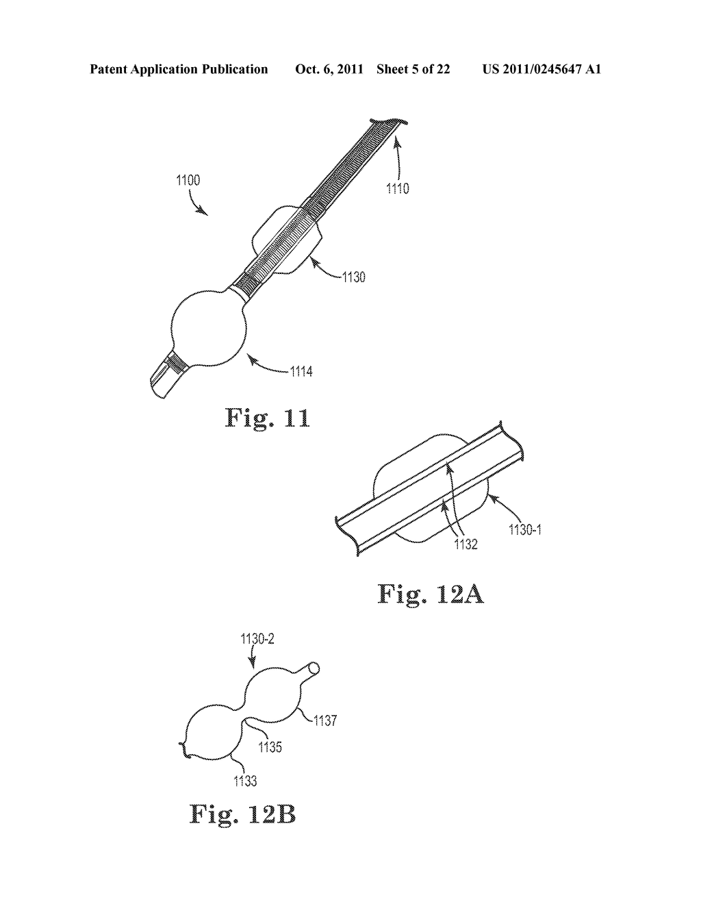 ENDOTRACHEAL TUBE APPARATUS - diagram, schematic, and image 06