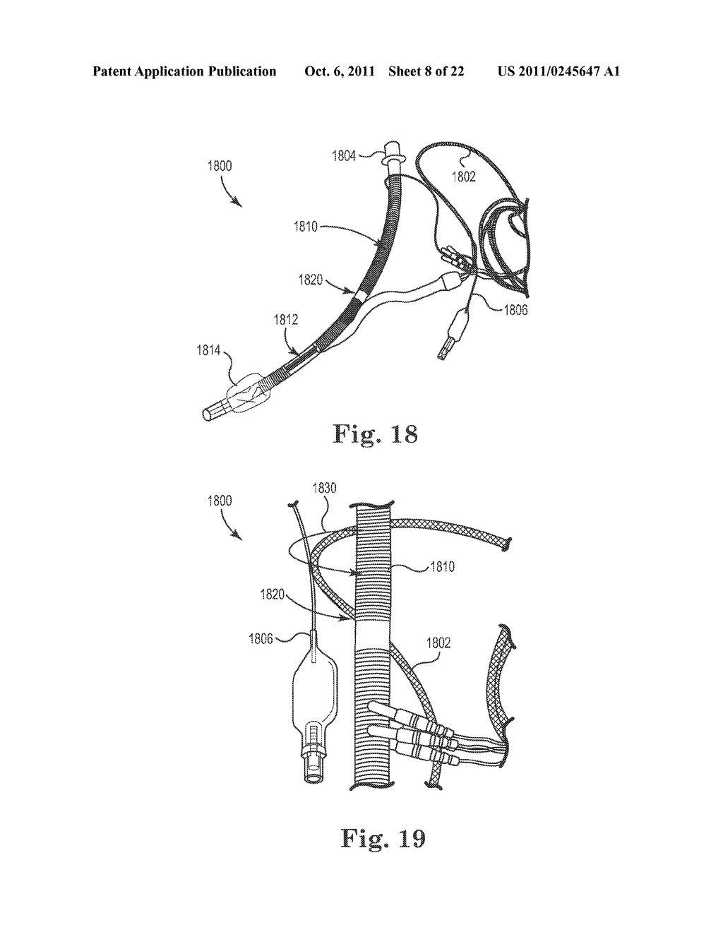 ENDOTRACHEAL TUBE APPARATUS - diagram, schematic, and image 09