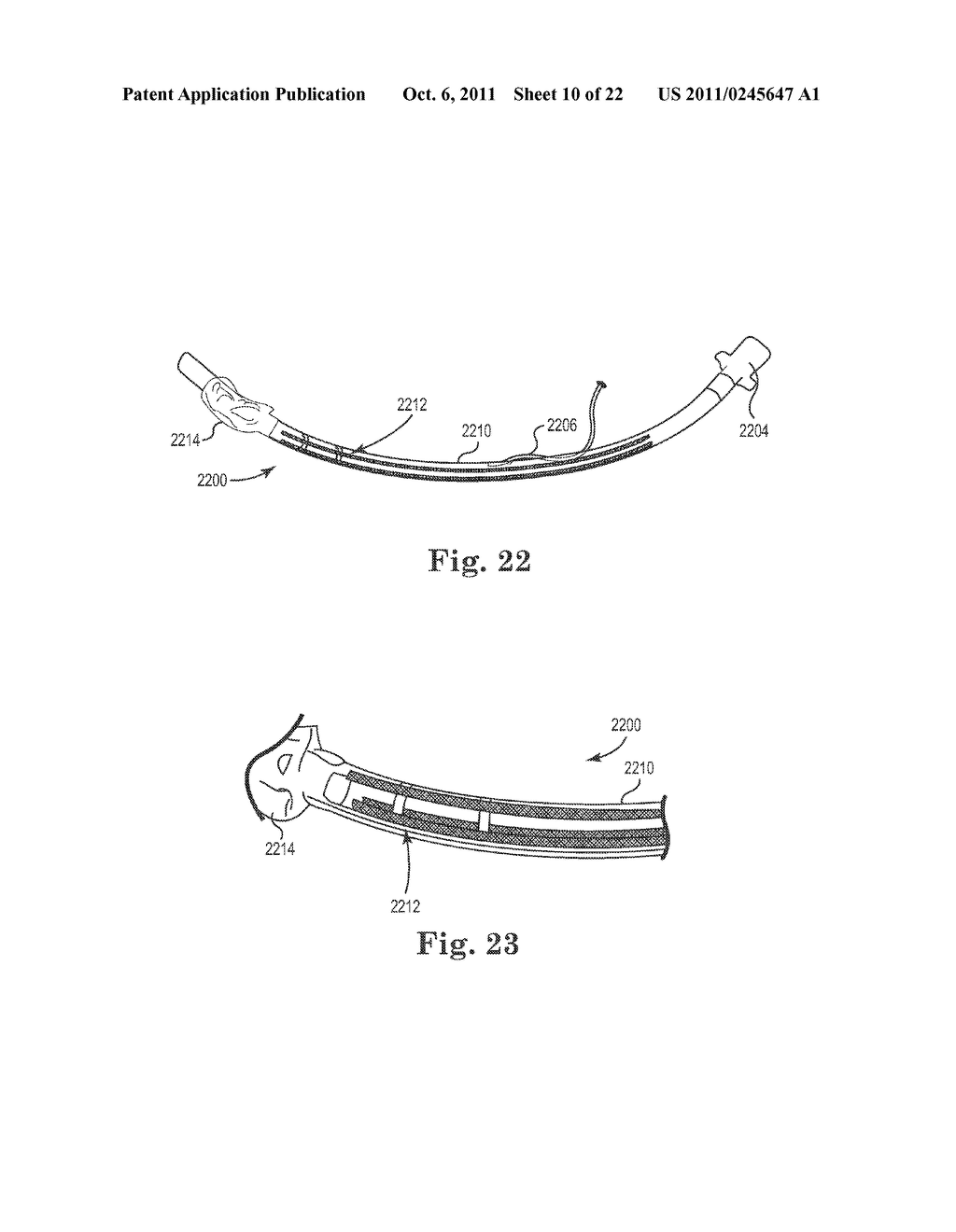 ENDOTRACHEAL TUBE APPARATUS - diagram, schematic, and image 11