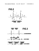 MEDICAL IMAGE PLAYBACK DEVICE AND METHOD, AS WELL AS PROGRAM diagram and image