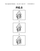 MEDICAL IMAGE PLAYBACK DEVICE AND METHOD, AS WELL AS PROGRAM diagram and image