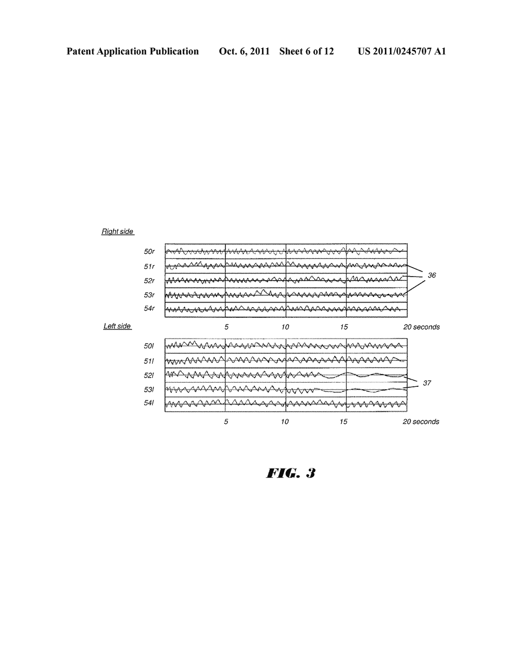 PORTABLE STROKE MONITORING APPARATUS - diagram, schematic, and image 07