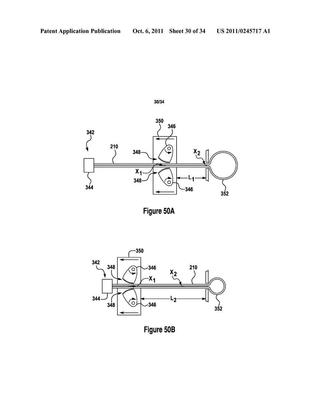 TISSUE EXCISION DEVICE WITH AN EXPANDING LOCALIZATION NEEDLE - diagram, schematic, and image 31