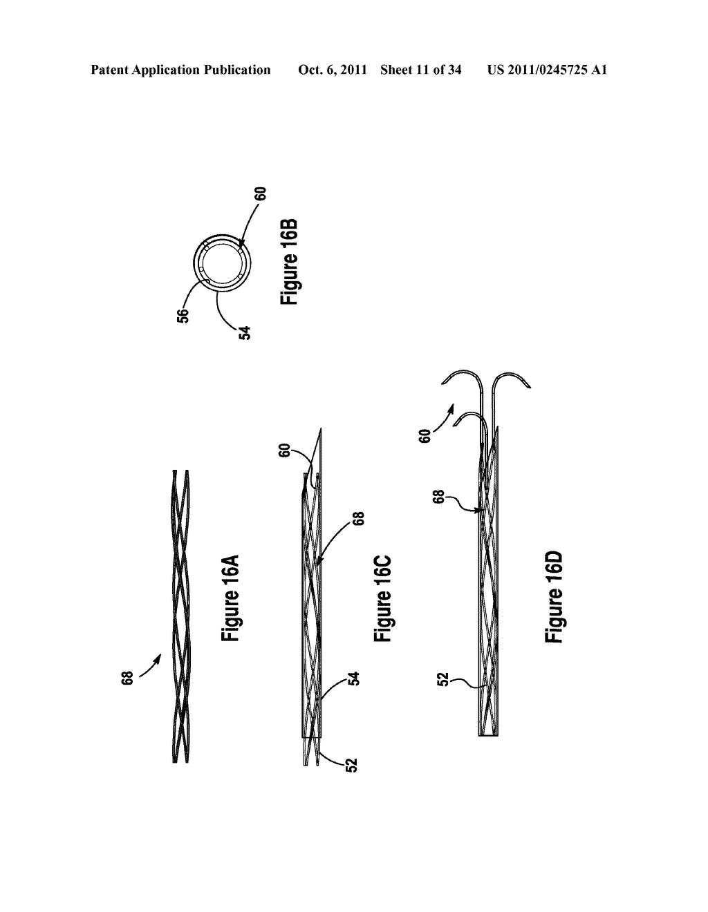 TISSUE EXCISION DEVICE WITH A COLLAPSIBLE STYLET - diagram, schematic, and image 12