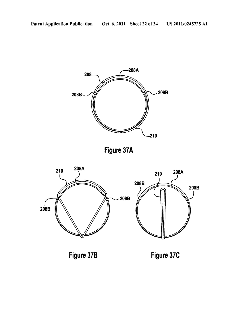 TISSUE EXCISION DEVICE WITH A COLLAPSIBLE STYLET - diagram, schematic, and image 23