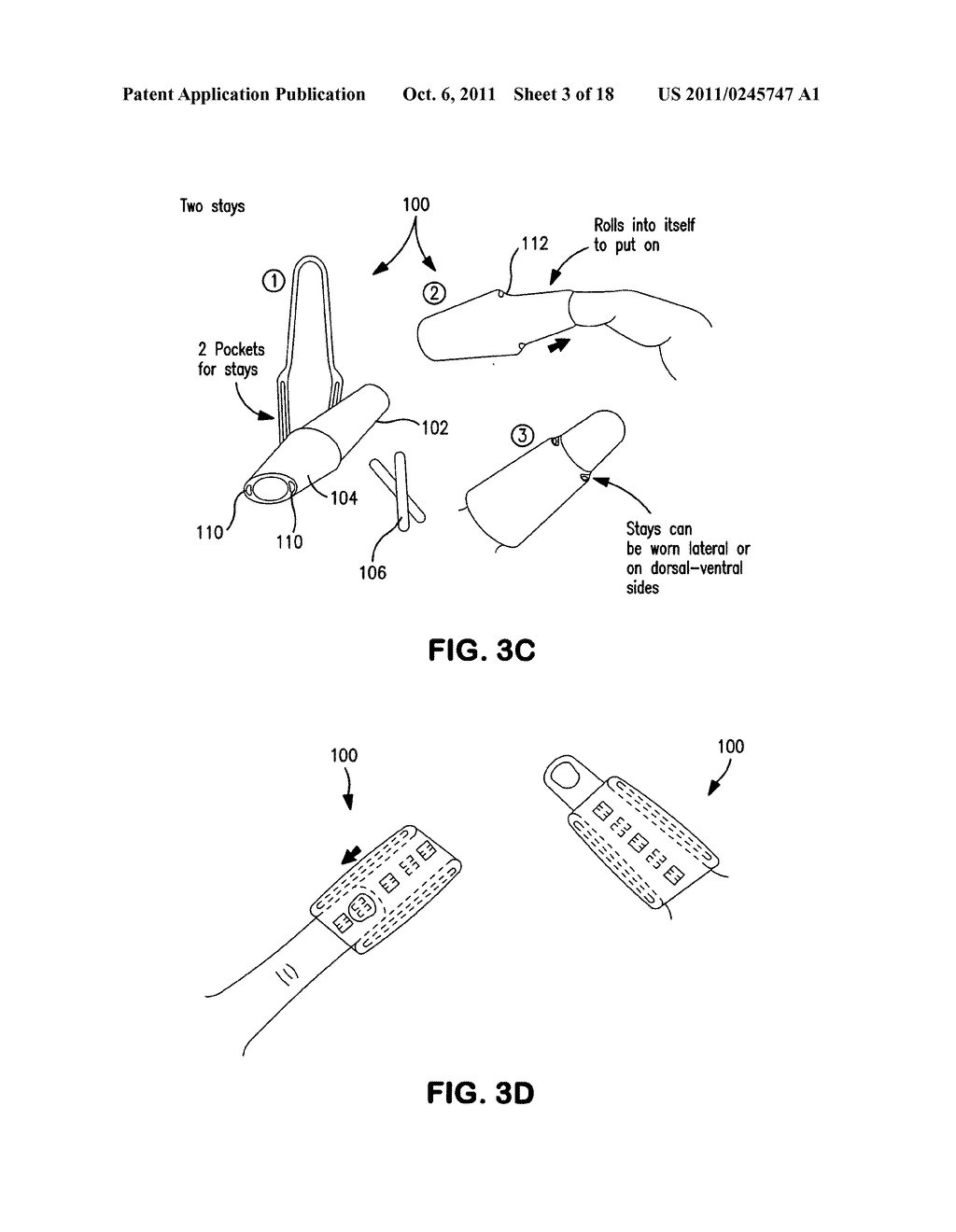 Splint for treatment of musculoskeletal injury of the hand - diagram, schematic, and image 04