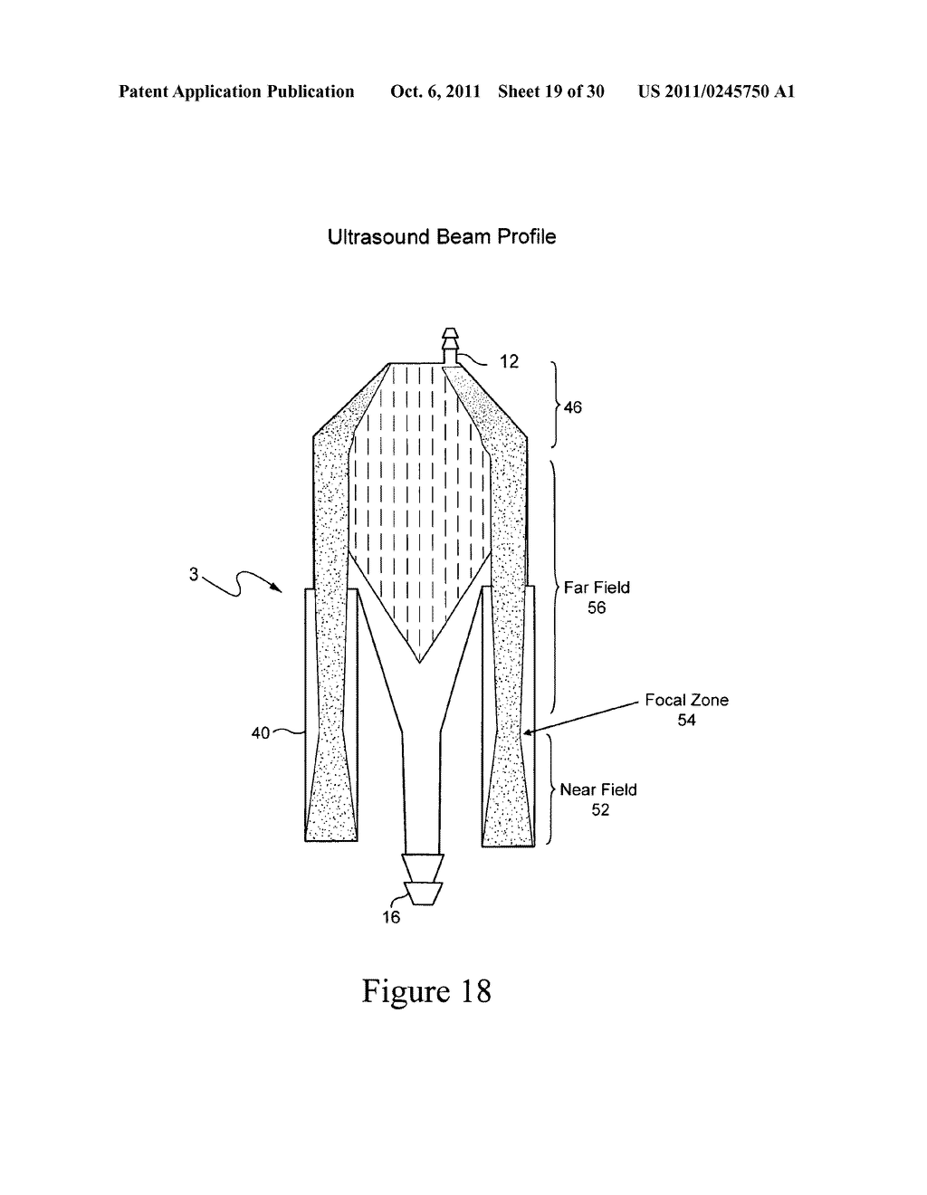 METHOD AND APPARATUS FOR ACOUSTICALLY ENHANCED REMOVAL OF BUBBLES FROM A     FLUID - diagram, schematic, and image 20