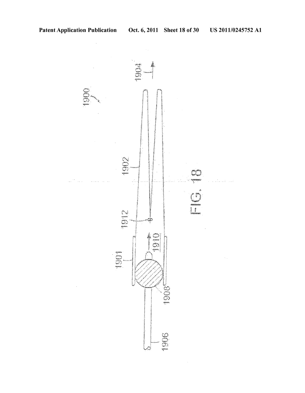 METHODS OF TREATMENT USING A BARIATRIC SLEEVE - diagram, schematic, and image 19