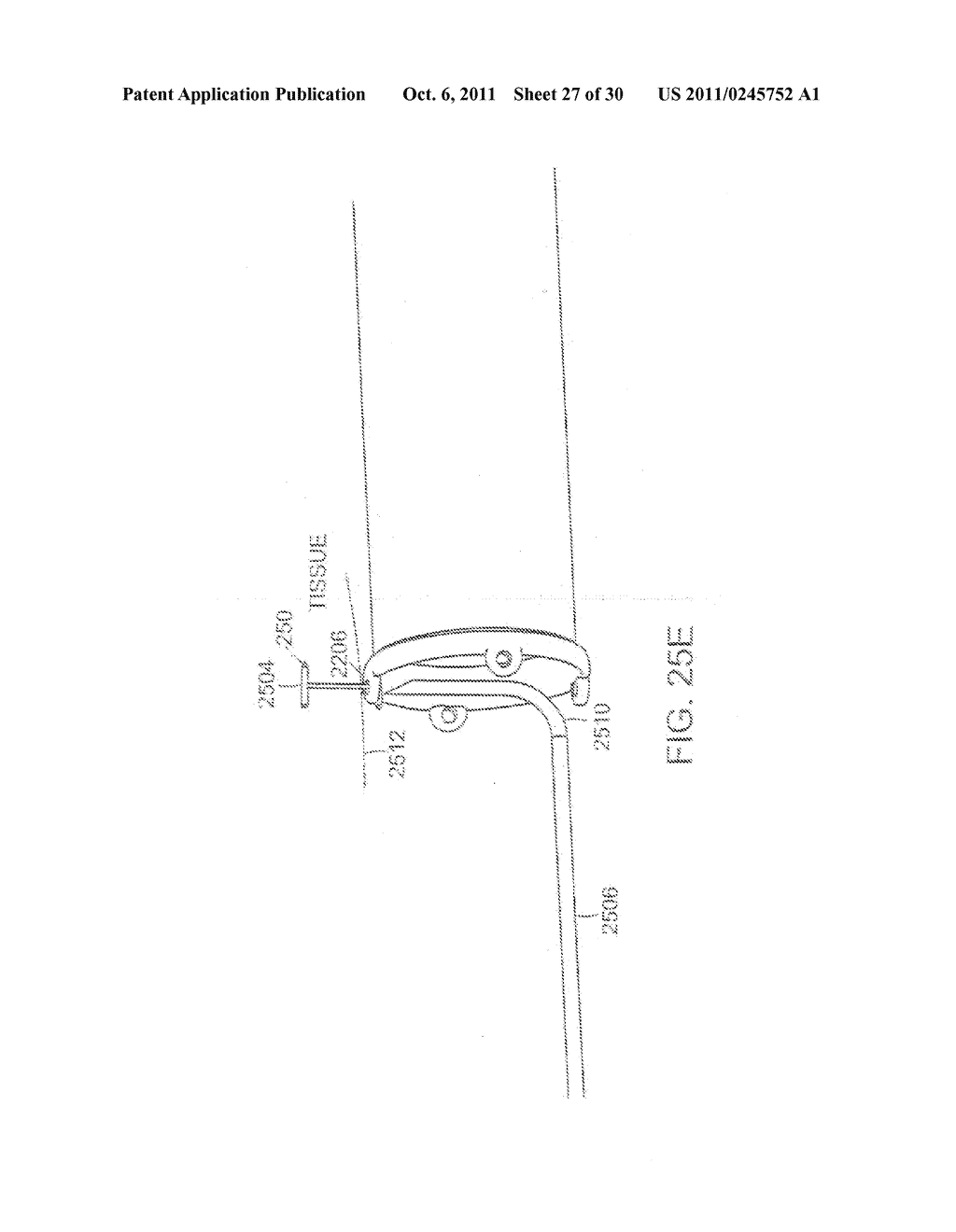 METHODS OF TREATMENT USING A BARIATRIC SLEEVE - diagram, schematic, and image 28